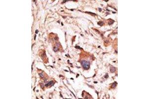 Image no. 1 for anti-Melanoma Antigen Family D, 1 (MAGED1) (Middle Region) antibody (ABIN358657) (MAGED1 抗体  (Middle Region))