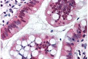 Human Small Intestine (formalin-fixed, paraffin-embedded) stained with SRI antibody ABIN290232 at 10 ug/ml followed by biotinylated goat anti-rabbit IgG secondary antibody ABIN481713, alkaline phosphatase-streptavidin and chromogen. (SRI 抗体  (AA 50-100))