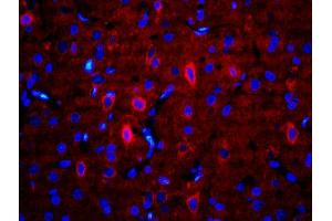Formalin-fixed and paraffin-embedded rat brain labeled with Anti-RALDH2 Polyclonal Antibody, Unconjugatedused at 1:200 dilution for 40 minutes at 37°C. (ALDH1A2 抗体  (AA 441-518))