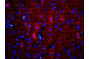 Formalin-fixed and paraffin-embedded rat brain labeled with Anti-RALDH2 Polyclonal Antibody, Unconjugatedused at 1:200 dilution for 40 minutes at 37°C.