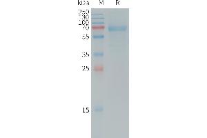 Human Protein, mFc Tag on SDS-PAGE under reducing condition.