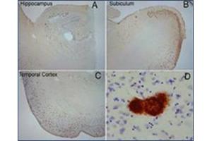 Extensive OC labeling was observed in the hippocampus (A), subiculum (B) and frontal cortex (C) in Alzheimer disease. (Amyloid Fibrils 抗体)