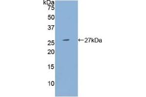 Detection of Recombinant PSG1, Human using Polyclonal Antibody to Pregnancy Specific Beta-1-Glycoprotein 1 (PSG1) (PSG1 抗体  (AA 202-401))