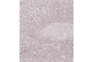 Immunohistochemistry (Paraffin-embedded Sections) (IHC (p)) image for anti-B-Cell CLL/lymphoma 2 (BCL2) (AA 75-110) antibody (ABIN388095)