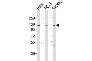 All lanes : Anti-SLCO1B3 Antibody (C-term) at 1:2000 dilution Lane 1: Hela whole cell lysates Lane 2: PC-3 whole cell lysates Lane 3: S whole cell lysates Lysates/proteins at 20 μg per lane.