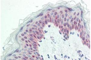 Human Skin: Formalin-Fixed, Paraffin-Embedded (FFPE) (HNRNPH2 抗体  (AA 156-205))