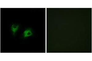 Immunofluorescence analysis of COS7 cells, using CELSR2 Antibody. (CELSR2 抗体  (AA 2781-2830))