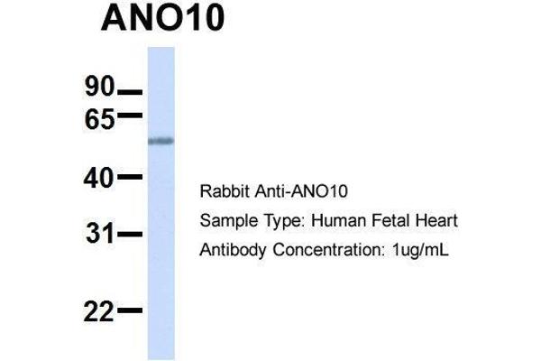 Anoctamin 10 抗体  (C-Term)