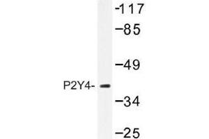 Image no. 1 for anti-Pyrimidinergic Receptor P2Y, G-Protein Coupled, 4 (P2RY4) antibody (ABIN317768) (P2RY4 抗体)
