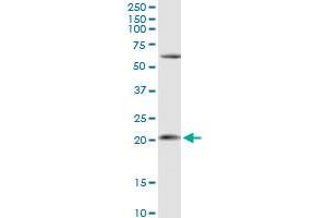 APRT MaxPab rabbit polyclonal antibody. (APRT 抗体  (AA 1-180))