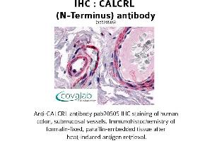 Image no. 1 for anti-Calcitonin Receptor-Like (CALCRL) (Extracellular Domain), (N-Term) antibody (ABIN1732561) (CALCRL 抗体  (Extracellular Domain, N-Term))
