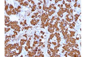 Immunohistochemistry (IHC) image for anti-Growth Hormone 1 (GH1) (AA 58-187) antibody (ABIN6939510)