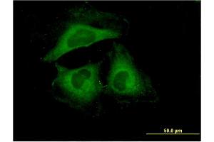 Immunofluorescence of monoclonal antibody to HSPB6 on HeLa cell. (HSPB6 抗体  (AA 1-160))