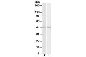 Western blot testing of mouse [A] and rat [B] eye lysates with RNF13 antibody at 2ug/ml. (RNF13 抗体)
