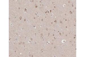ABIN6266665 at 1/100 staining human brain tissue sections by IHC-P. (TRADD 抗体)