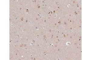 ABIN6266665 at 1/100 staining human brain tissue sections by IHC-P.