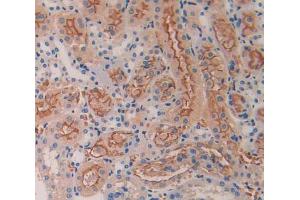 IHC-P analysis of kidney tissue, with DAB staining. (BMP5 抗体  (AA 201-314))