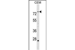 Western blot analysis in CEM cell line lysates (35ug/lane). (ABLIM3 抗体  (C-Term))