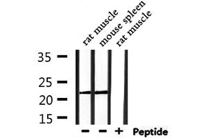 Western blot analysis of extracts from rat muscle,mouse spleen, using PRDX2 Antibody. (Peroxiredoxin 2 抗体  (C-Term))
