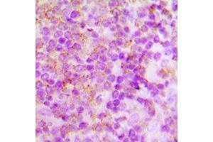 Immunohistochemical analysis of p40 phox staining in human tonsil formalin fixed paraffin embedded tissue section. (NCF4 抗体  (Center))