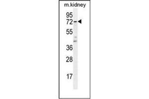 Western blot analysis of TBXAS1 Antibody  in Mouse kidney tissue lysates (35ug/lane). (TBXAS1 抗体  (Middle Region))