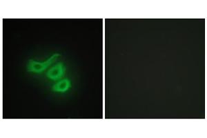 Immunofluorescence analysis of HepG2 cells, using M-CK antibody. (CKM 抗体  (N-Term))