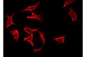 ABIN6269034 staining Hela by IF/ICC. (TNFAIP6 抗体  (N-Term))