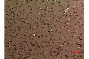 Immunohistochemistry (IHC) analysis of paraffin-embedded Rat Brain, antibody was diluted at 1:100. (Myosin VI 抗体  (N-Term))