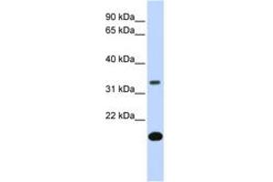 Image no. 1 for anti-Follistatin (FST) (AA 144-193) antibody (ABIN6743094) (Follistatin 抗体  (AA 144-193))