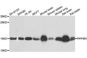 Western blot analysis of extracts of various cells, using PPP3R1 antibody. (PPP3R1 抗体)