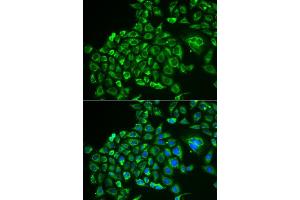Immunofluorescence analysis of MCF-7 cells using RCVRN antibody (ABIN5973805). (Recoverin 抗体)