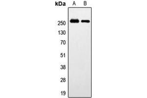 Western blot analysis of GPR179 expression in HeLa (A), SP2/0 (B) whole cell lysates. (GPR179 抗体  (Center))