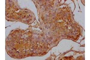 IHC image of ABIN7144227 diluted at 1:500 and staining in paraffin-embedded human testis tissue performed on a Leica BondTM system. (ANKRD42 抗体  (AA 158-377))