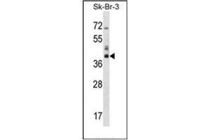 Western blot analysis of HSD17B1 Antibody (C-term) in SK-BR-3 cell line lysates (35ug/lane). (HSD17B1 抗体  (C-Term))