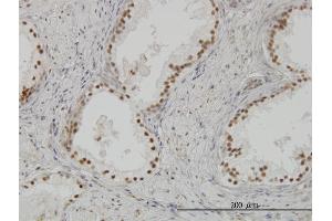 Immunoperoxidase of monoclonal antibody to CLK3 on formalin-fixed paraffin-embedded human prostate. (CLK3 抗体  (AA 36-136))