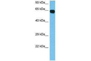 Host:  Mouse  Target Name:  CRMP1  Sample Tissue:  Mouse Brain  Antibody Dilution:  1ug/ml (CRMP1 抗体  (N-Term))