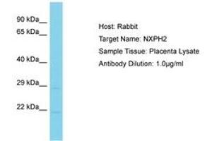 Image no. 1 for anti-Neurexophilin 2 (NXPH2) (AA 161-210) antibody (ABIN6750586) (NXPH2 抗体  (AA 161-210))