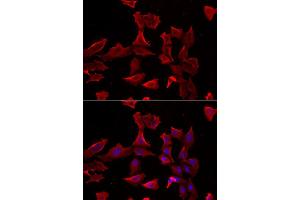 Immunofluorescence analysis of HeLa cell using ADSS antibody. (ADSS 抗体)