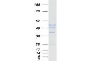 Western Blotting (WB) image for Melanoma Antigen Family A, 8 (MAGEA8) protein (Myc-DYKDDDDK Tag) (ABIN2725180)