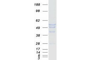 MAGEA8 Protein (Myc-DYKDDDDK Tag)