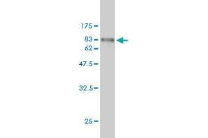 Western Blot detection against Immunogen (67. (FGFR1OP 抗体  (AA 1-379))