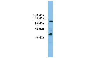 POLR1B antibody used at 1 ug/ml to detect target protein. (POLR1B 抗体)