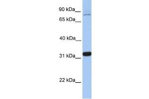 TIPIN antibody used at 0. (TIPIN 抗体  (Middle Region))