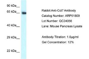 Western Blotting (WB) image for anti-Chaperonin Containing TCP1, Subunit 7 (Eta) (CCT7) (C-Term) antibody (ABIN2784637) (CCT7 抗体  (C-Term))