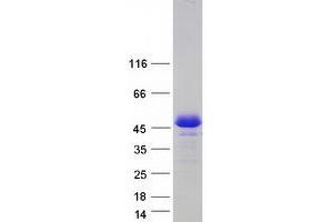 Western Blotting (WB) image for Homer Homolog 2 (HOMER2) (Transcript Variant 2) protein (Myc-DYKDDDDK Tag) (ABIN2722957)