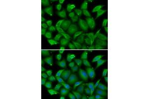Immunofluorescence analysis of HeLa cells using DEFA1 antibody (ABIN5974152). (alpha Defensin 1 抗体)