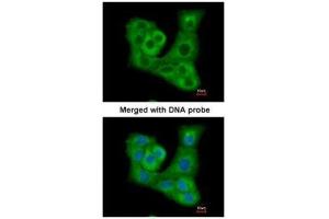ICC/IF Image Immunofluorescence analysis of paraformaldehyde-fixed A549, using DUSP7 , antibody at 1:200 dilution. (DUSP7 抗体  (C-Term))