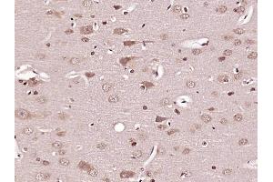 Paraformaldehyde-fixed, paraffin embedded Rat brain Antigen retrieval by boiling in sodium citrate buffer (pH6. (Caspase 6 抗体  (AA 181-293))