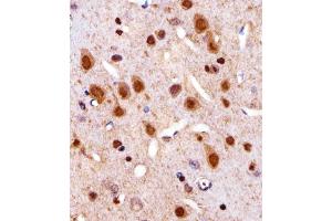 Immunohistochemistry (Paraffin-embedded Sections) (IHC (p)) image for anti-Cyclin-Dependent Kinase 4 (CDK4) (AA 272-303), (C-Term) antibody (ABIN1881714)
