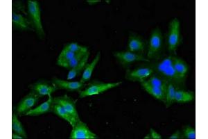 Immunofluorescent analysis of Hela cells using ABIN7145158 at dilution of 1:100 and Alexa Fluor 488-congugated AffiniPure Goat Anti-Rabbit IgG(H+L) (B-Cell Linker 抗体  (AA 41-337))